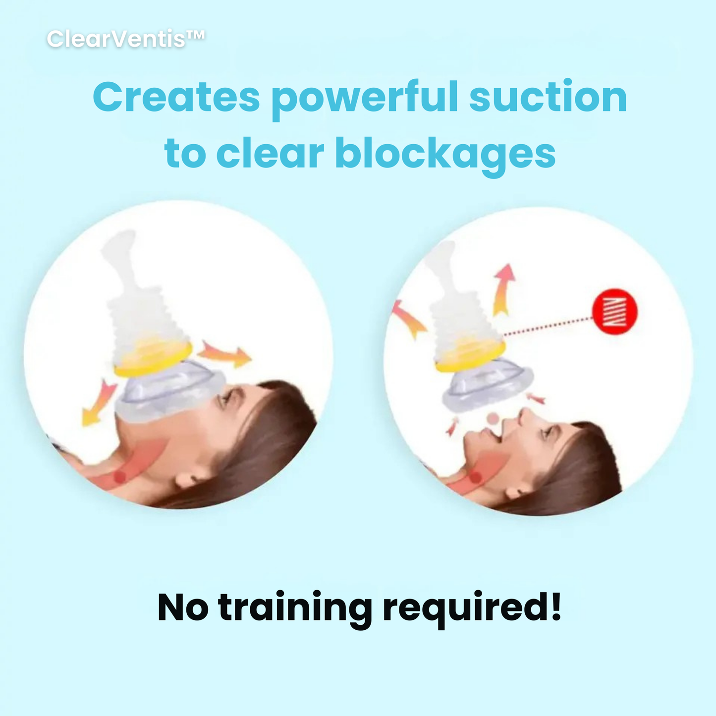 ClearVentis™ - Anti Choking Device